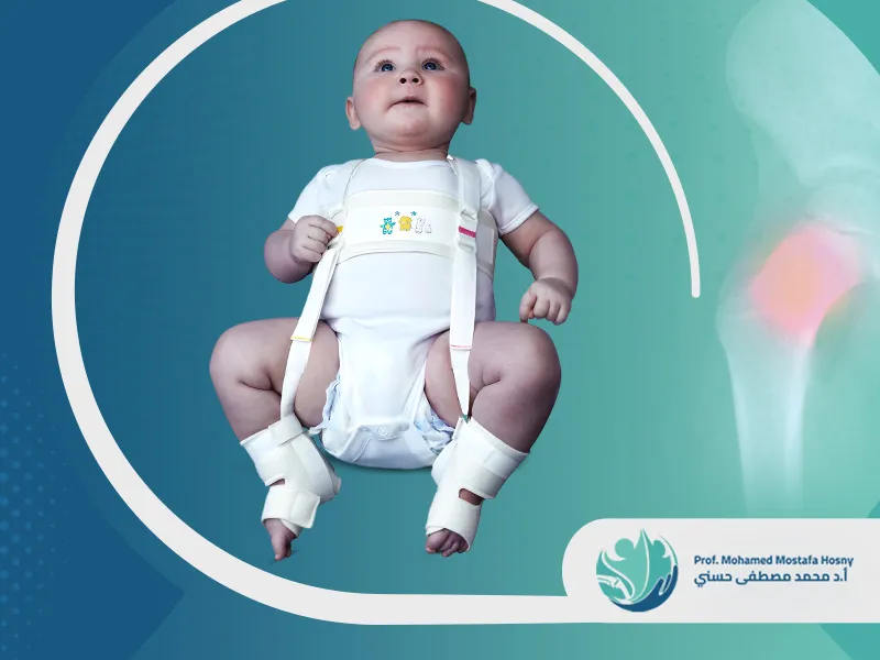 أعراض-خلع-الورك-عند-الأطفال-بالصور إليك أعراض خلع الورك عند الأطفال بالصور