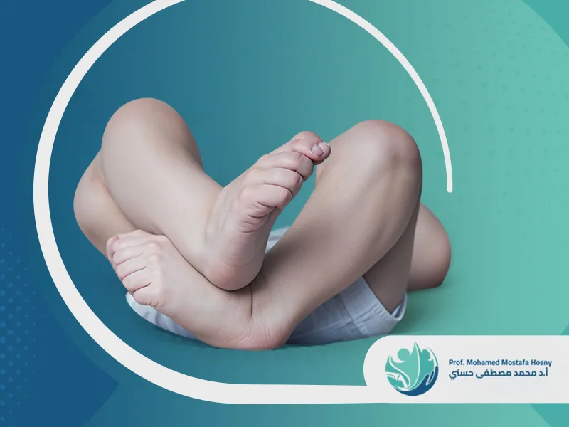 أنواع تشوهات القدم عند الأطفال