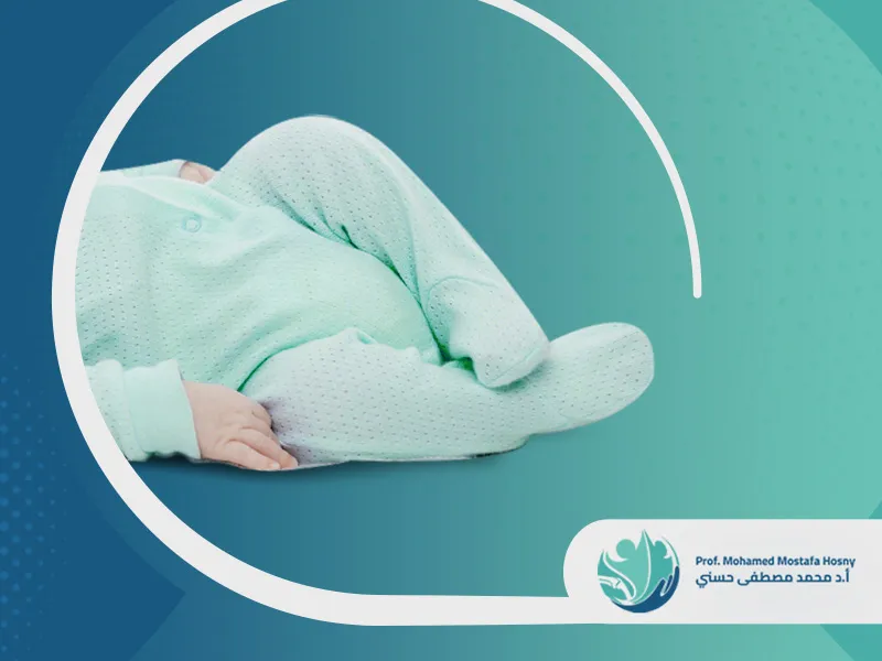 الرجل-المخلبية-عند-الاطفال كيفية علاج الرجل المخلبية عند الأطفال