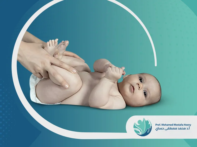 تقوس الساقين عند الرضع تقوس الساقين عند الرضع