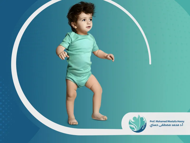 علاج-اعوجاج-القدم-للخارج علاج اعوجاج القدم عند الأطفال