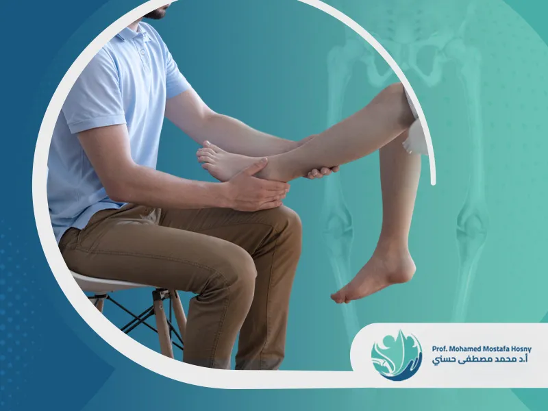 علاج-تقوس-الساقين-بالعلاج-الطبيعي هل يمكن علاج تقوس الساقين بالعلاج الطبيعي؟