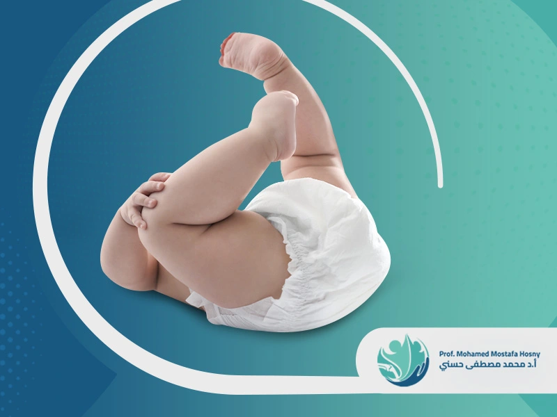 علاج حنف القدم البسيط