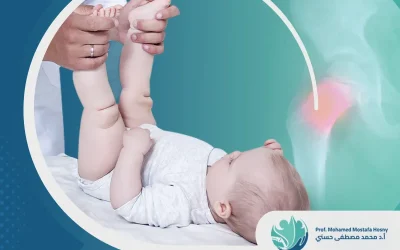 علاج خلع مفصل الحوض عند الأطفال: كل الأساليب