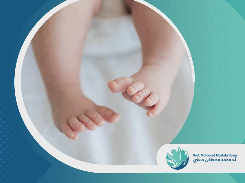 القدم المخلبية لحديثي الولادة