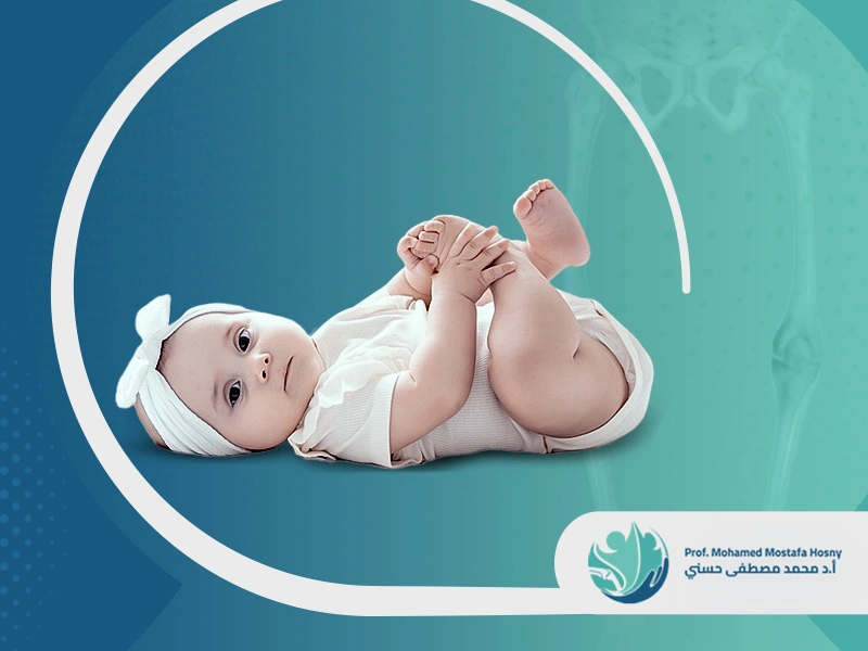 تجربتي مع عملية تقوس الساقين