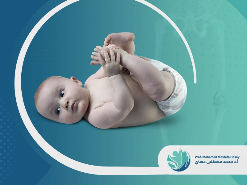 أسباب تقوس الساقين