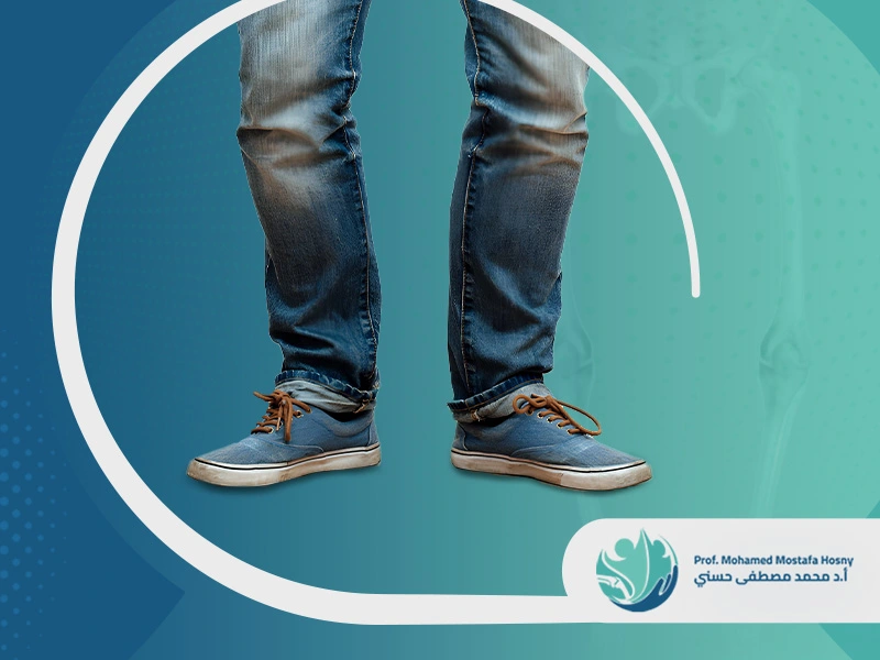 درجات تقوس الساقين عند الأطفال