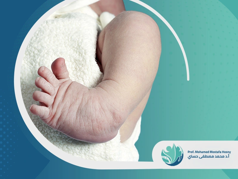 علاج-القدم-المخلبية-اهم-علاماته-واسبابه؟ القدم المخلبية