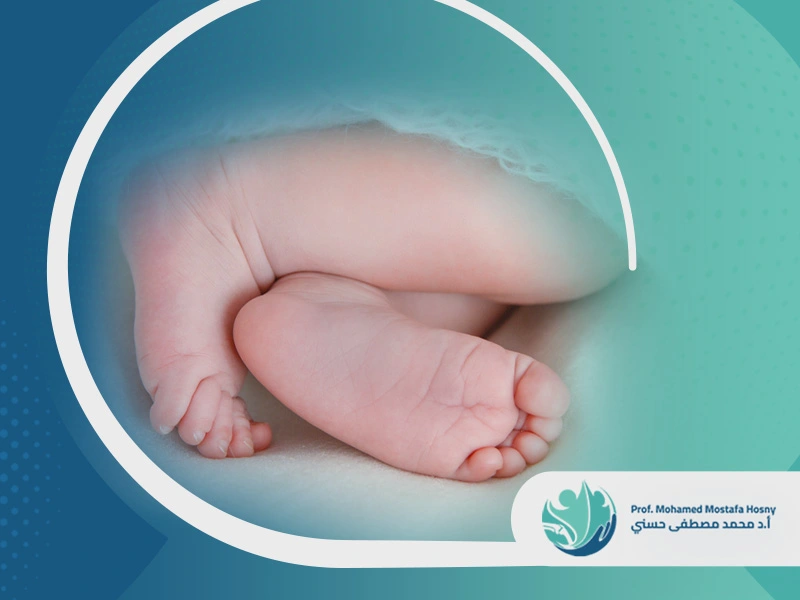 نسبة-نجاح-علاج-القدم-الحنفاء نسبة نجاح علاج القدم الحنفاء