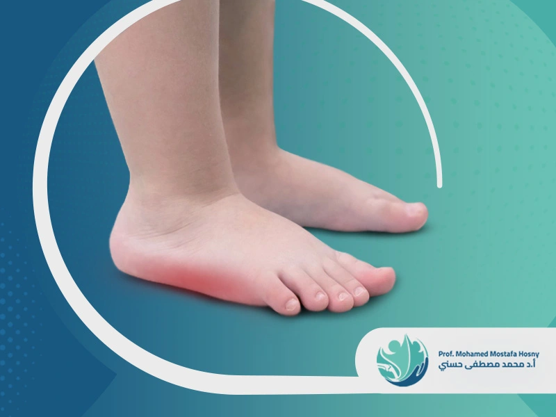 أضرار الفلات فوت