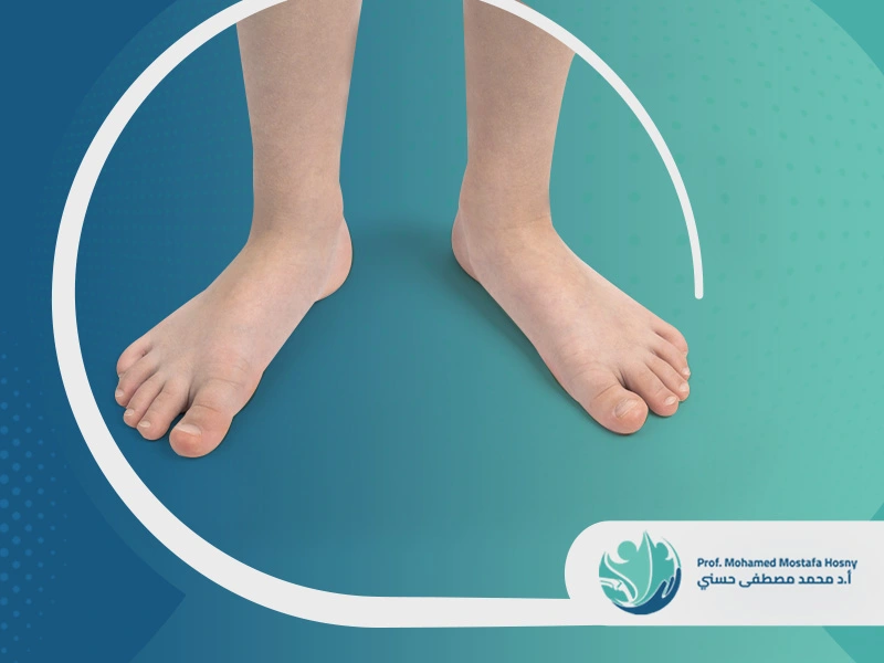 شكل الفلات فوت