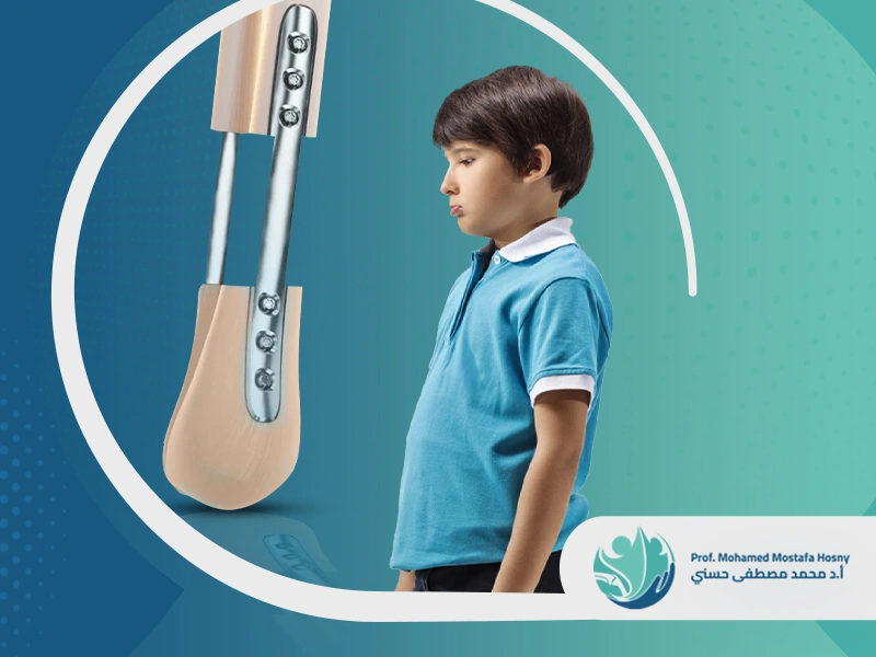 أضرار عملية زيادة الطول