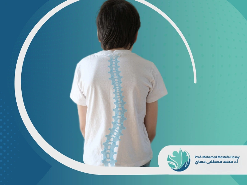 درجات اعوجاج العمود الفقري