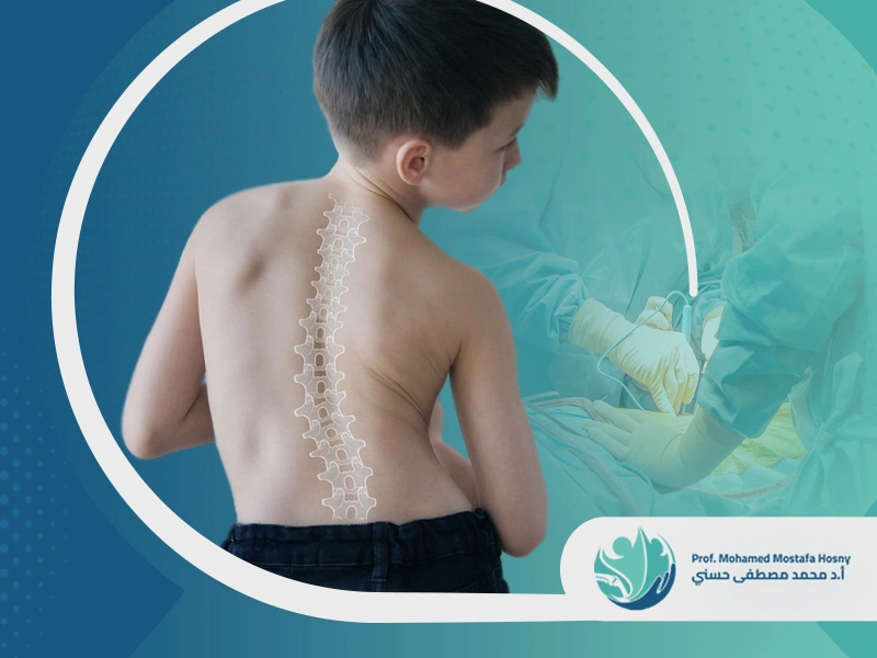 نسبة نجاح عملية اعوجاج العمود الفقري