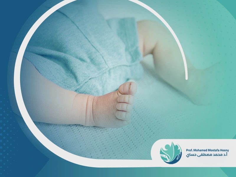 لين العظام عند الرضع